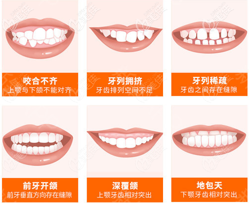 北京壹加壹牙科張建朋擅長牙齒矯正 北京壹加壹牙科張建朋擅長牙齒矯正