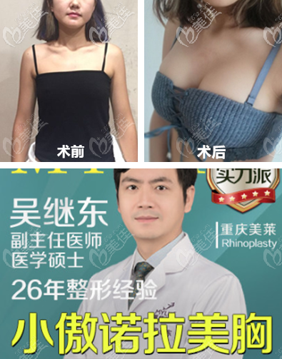 重慶美萊在重慶做胸怎么樣 重慶美萊在重慶做胸怎么樣