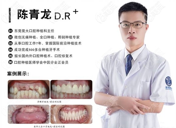 東莞寮步莞大口腔種植主任陳青龍 東莞寮步莞大口腔種植主任陳青龍