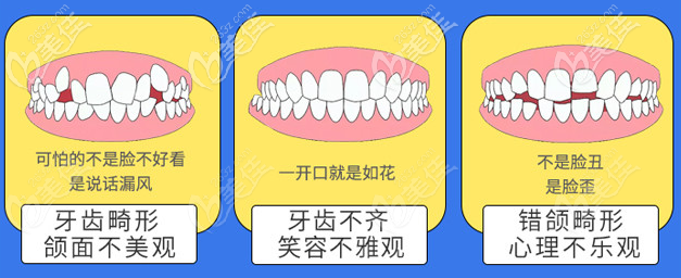 北京壹加壹口腔擅長(zhǎng)各種牙齒畸形矯正