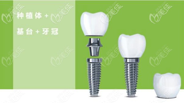 江醫(yī)生擅長牙齒缺失種植