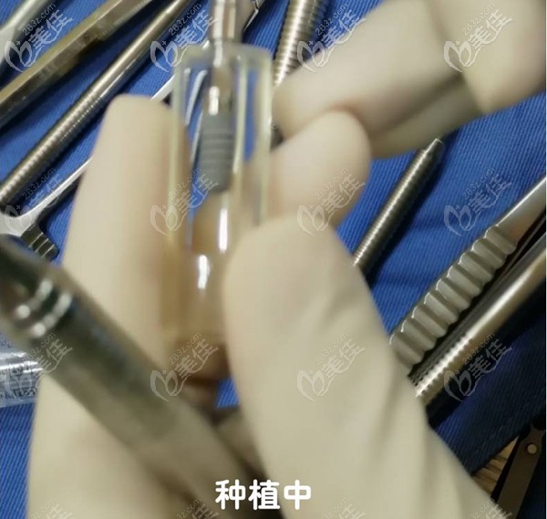 做瑞士ITI種植牙過(guò)程