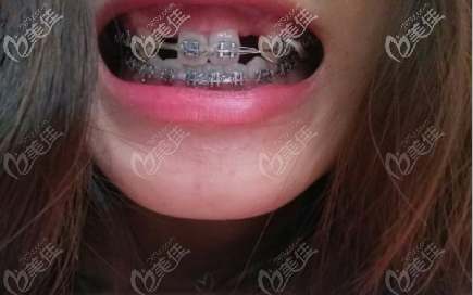 兩年多那會(huì)兒