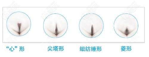 比基尼部位的毛發(fā) 比基尼部位的毛發(fā)