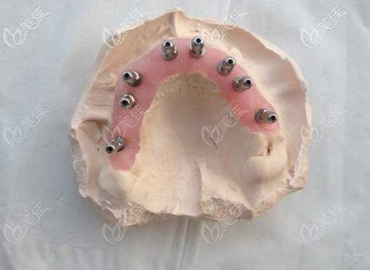 已經(jīng)生產(chǎn)好的導板