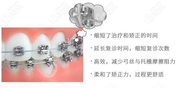 我想知道包頭3M自鎖托槽正畸一套1.6萬多元算便宜不？