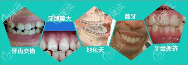 3M金屬托槽能解決的問題