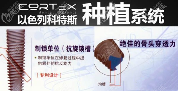 以色列科特斯種植體怎么樣 以色列科特斯種植體怎么樣