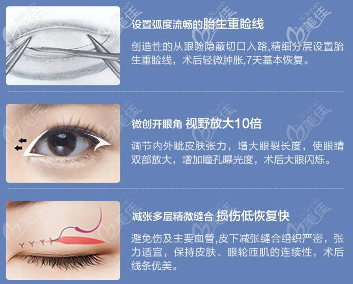 東莞科醫(yī)能何建峰雙眼皮優(yōu)勢(shì)