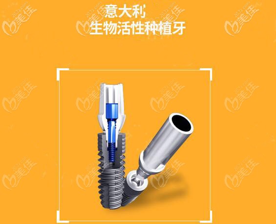 意大利種植牙怎么樣 意大利種植牙怎么樣