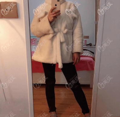 我做水動(dòng)力大腿吸脂有一個(gè)月了 我做水動(dòng)力大腿吸脂有一個(gè)月了