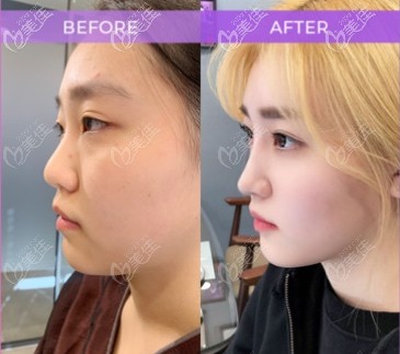 韓國麗顏麗醫(yī)院院長李韓爾在韓國做鼻子出名不？