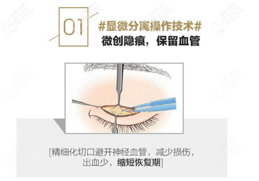 朱建瑩眼部整形縫合技術(shù)