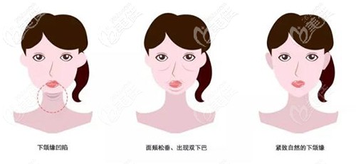下頜緣的不同情況