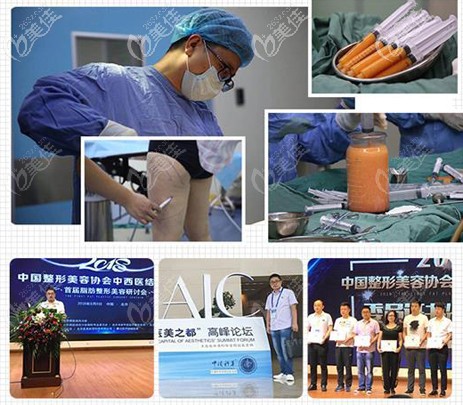 成都恒博天姿整形美容醫(yī)院在脂肪填充上的成就 成都恒博天姿整形美容醫(yī)院在脂肪填充上的成就