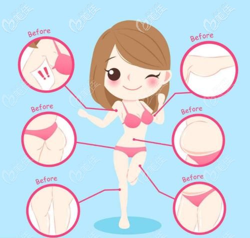 360環(huán)吸適合的部位