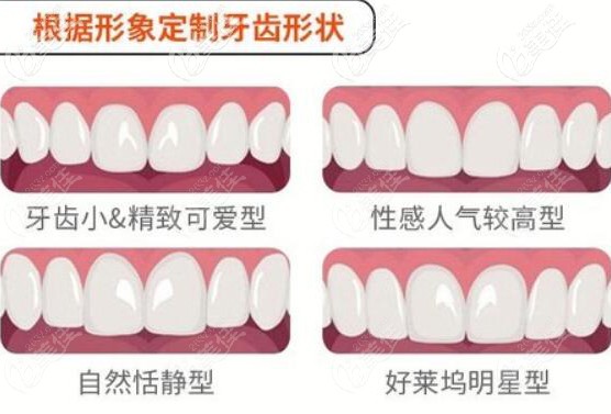 程紅梅擅于根據(jù)形象定制牙齒形狀