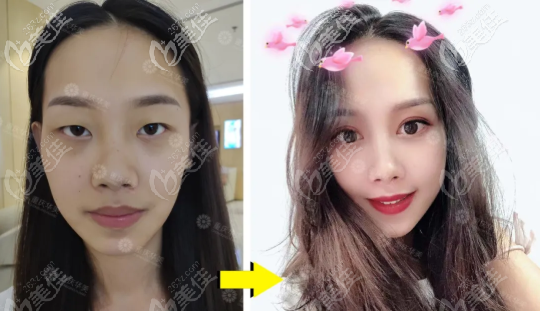 重慶華美眼鼻案例