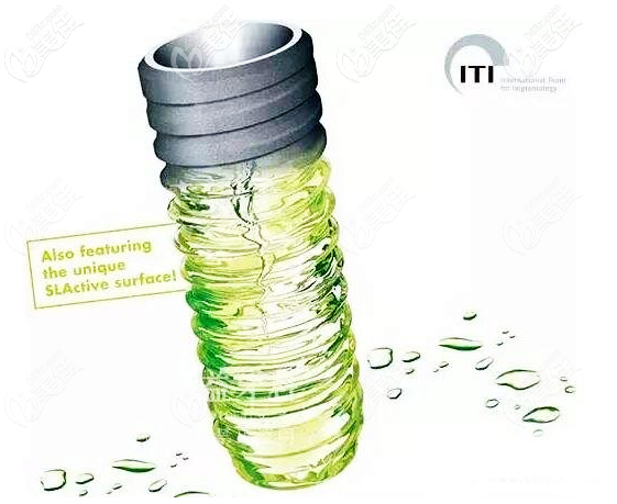 種植牙德國(guó)bego和瑞士iti哪個(gè)好 種植牙德國(guó)bego和瑞士iti哪個(gè)好