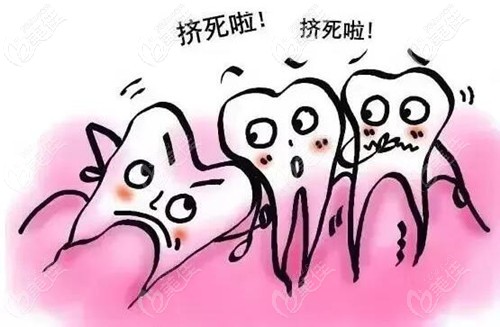 牙齒矯正為什么要拔牙