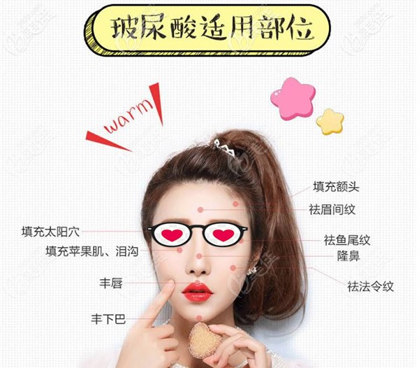 玻尿酸可以填充哪些部位 玻尿酸可以填充哪些部位