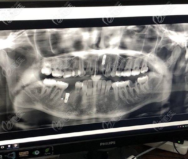 在濟南美奧拍CT 在濟南美奧拍CT