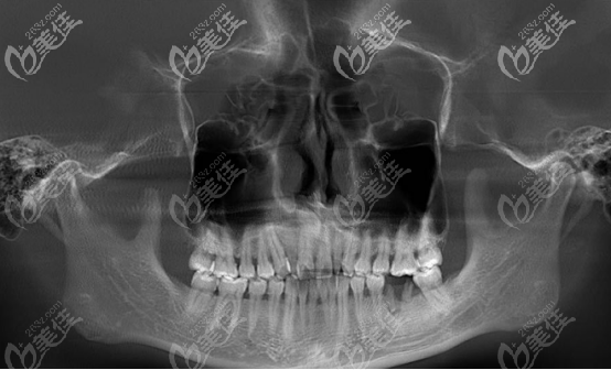 20201012_1602496765896411.png image.png