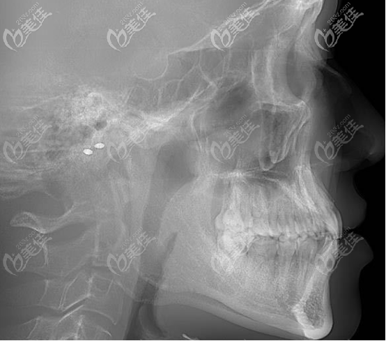 20201012_1602496906279326.png image.png