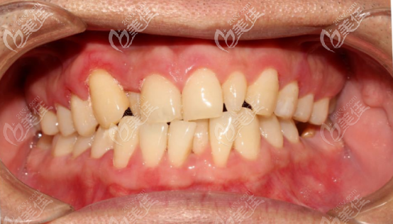 20201012_1602496991188808.png image.png