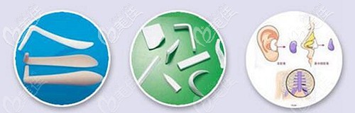 隆鼻常見的材料和自體軟骨