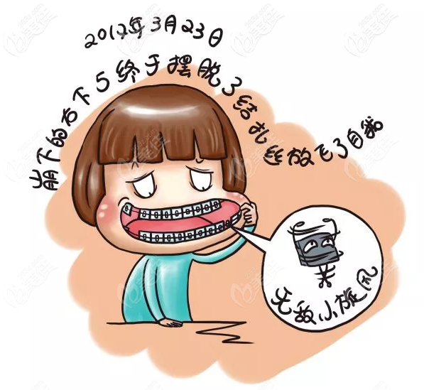 兒童適合戴傳統(tǒng)鋼牙套還是隱形牙套 兒童適合戴傳統(tǒng)鋼牙套還是隱形牙套