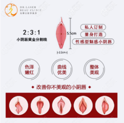 小陰唇手術(shù)圖示 小陰唇手術(shù)圖示