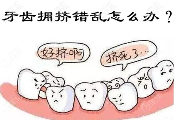 牙齒擁擠錯亂怎么辦 牙齒擁擠錯亂怎么辦