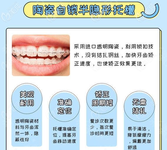 梅州中大口腔半隱形陶瓷自鎖托槽 梅州中大口腔半隱形陶瓷自鎖托槽