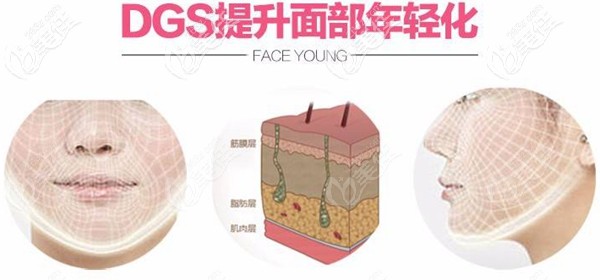 北京南加DGS四維青春復原術