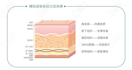 面部提升線“緊戀” 面部提升線“緊戀”