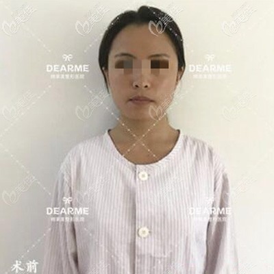 術(shù)前 術(shù)前