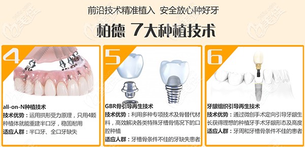 柏德口腔7大種植技術(shù) 柏德口腔7大種植技術(shù)