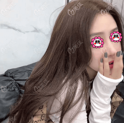 做面部脂肪填充塑形一個(gè)月 做面部脂肪填充塑形一個(gè)月