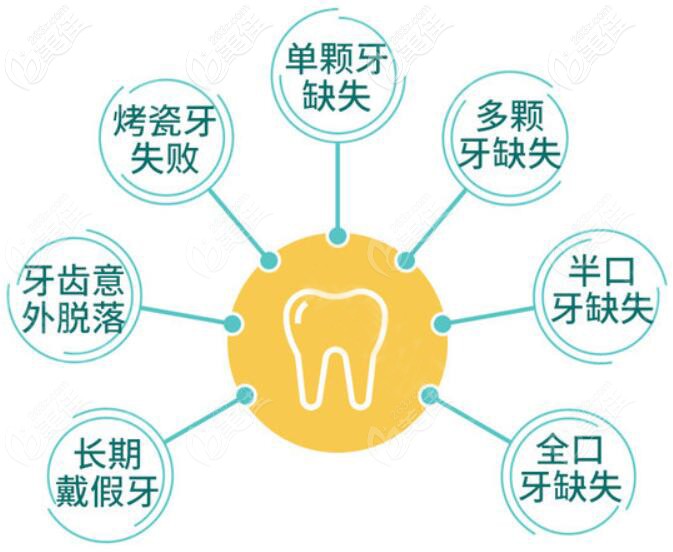 需要做種植牙的人群 需要做種植牙的人群