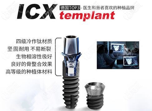 德國icx種植體