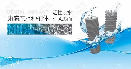 國(guó)產(chǎn)康盛親水種植體 國(guó)產(chǎn)康盛親水種植體