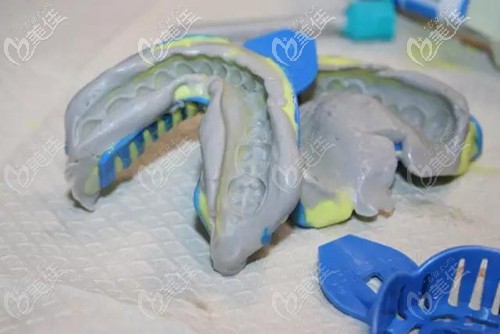 隱形矯正的復(fù)雜手術(shù)過(guò)程 隱形矯正的復(fù)雜手術(shù)過(guò)程