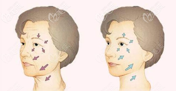 白孝梅醫(yī)生做面部除皺手術(shù)