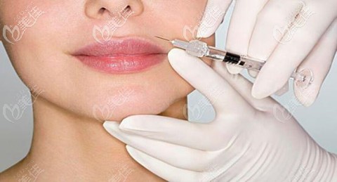 唐艷杰注射微整形風格