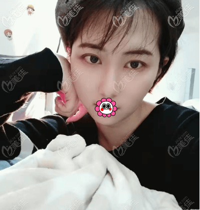 <!--<i data=20240703-sp></i>-->醫(yī)生給我做面部抽脂5個多月了