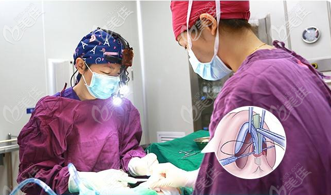 深圳富華高靜隆鼻怎么樣手術過程圖 深圳富華高靜隆鼻怎么樣手術過程圖