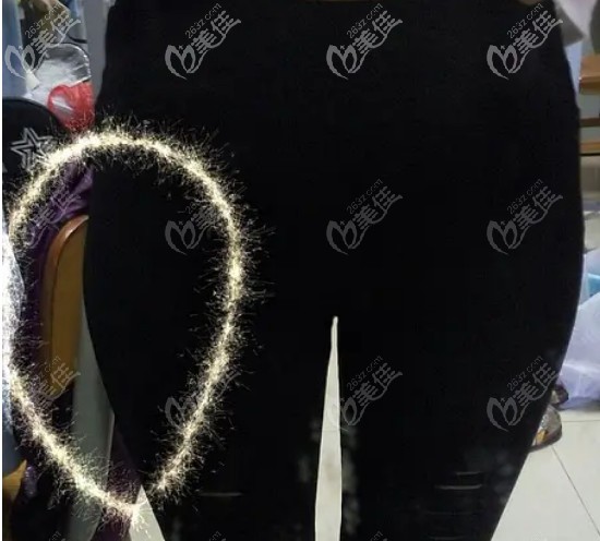 大腿外側(cè)突出顯得腿粗