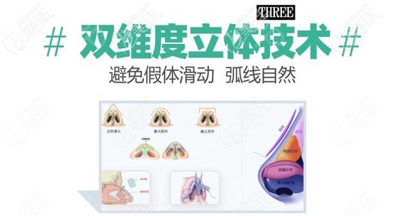 半肋骨加膨體隆鼻技術(shù) 半肋骨加膨體隆鼻技術(shù)