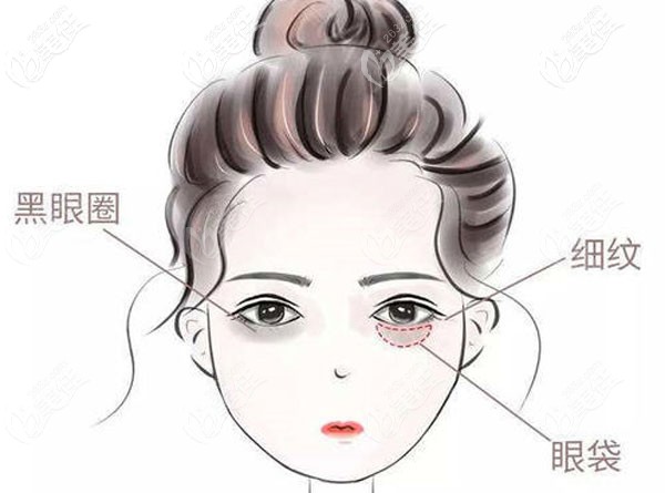 馮小良醫(yī)生眼部整形到底怎么樣呢